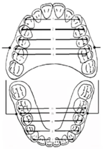 Archwires