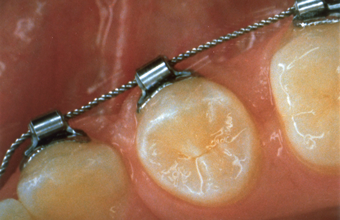 Clinical Rotation Example 2